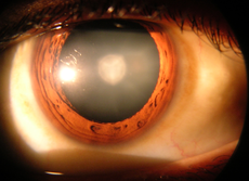 eye